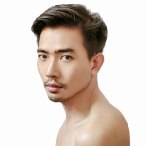 HAIR-RESTORATION-MAN